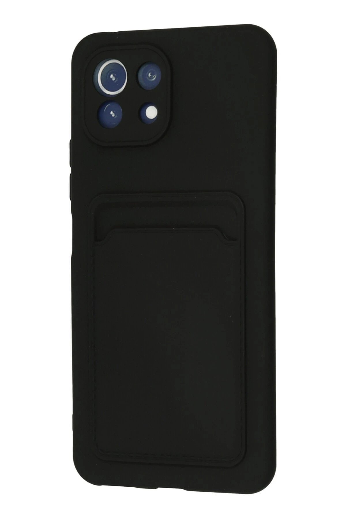 Newface Xiaomi Mi 11 Kılıf Kelvin Kartvizitli Silikon - Siyah