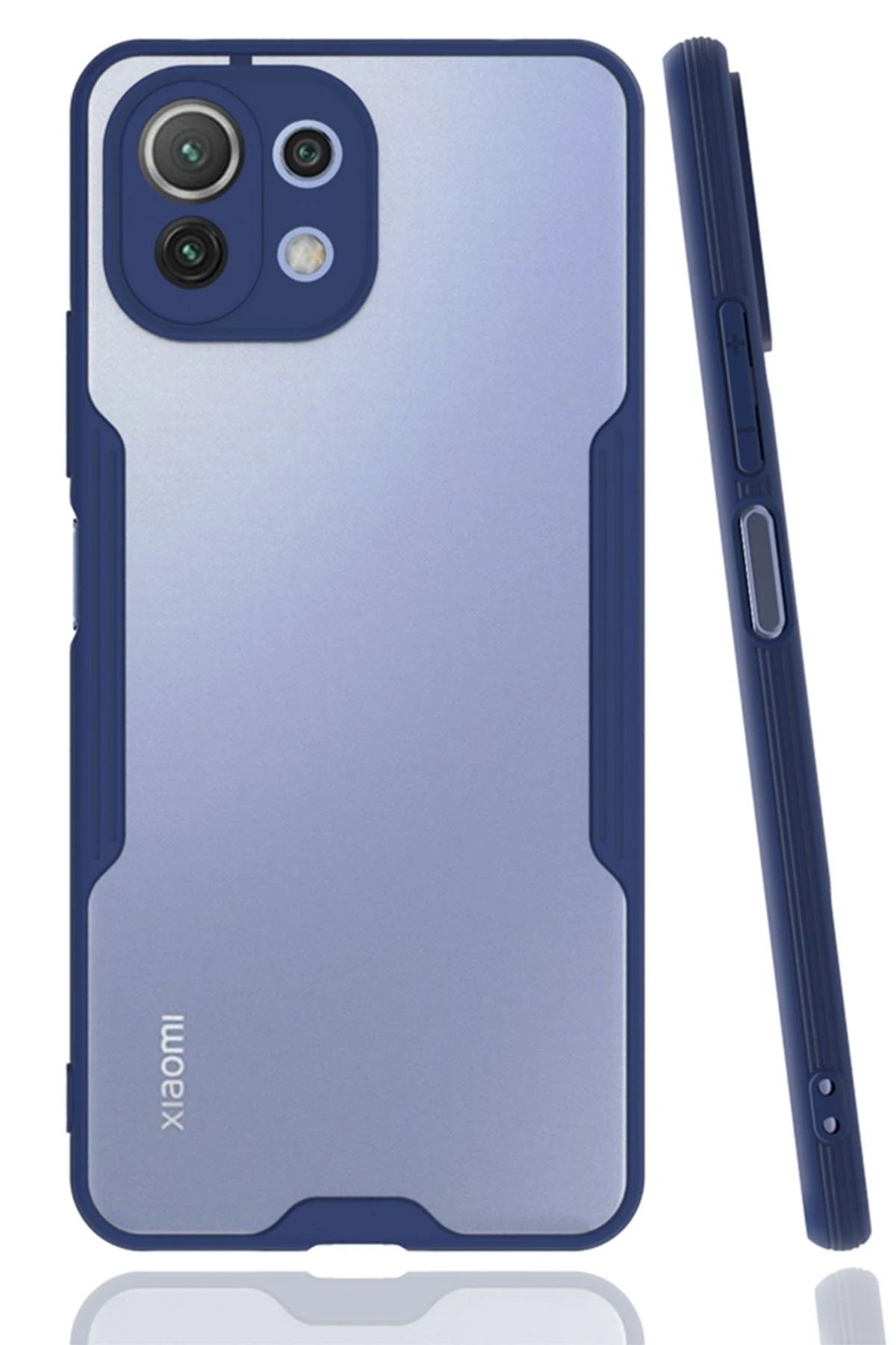 Newface Xiaomi Mİ 11 Lite Kılıf Platin Silikon - Lacivert