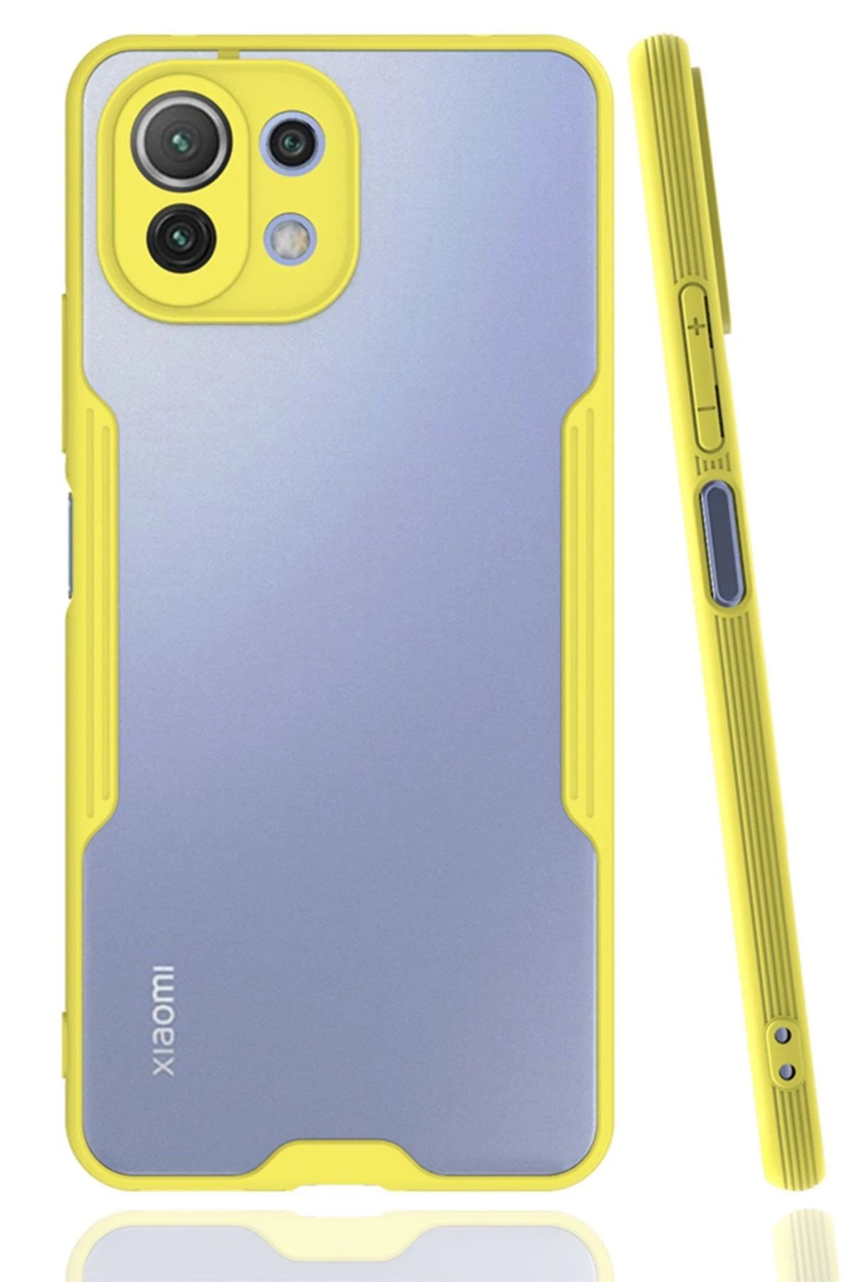 Newface Xiaomi Mİ 11 Lite Kılıf Platin Silikon - Sarı