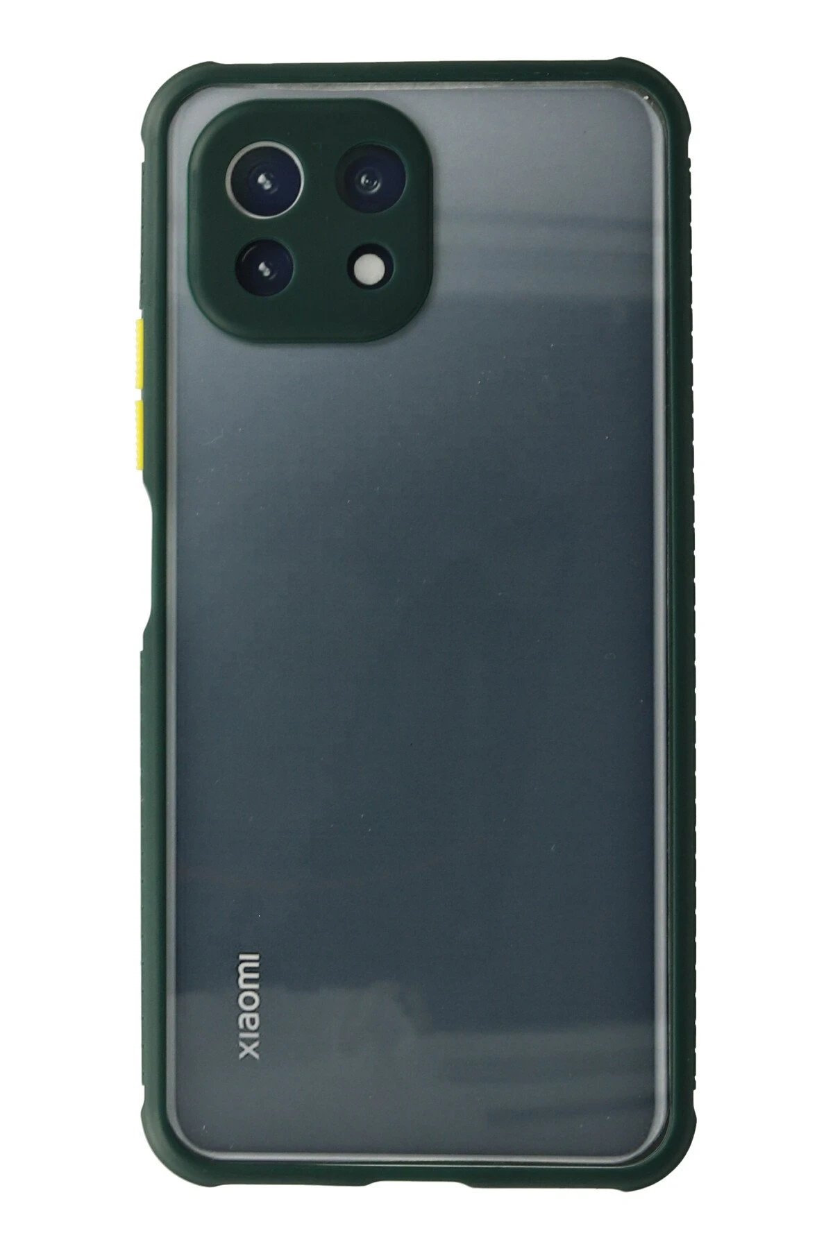 Newface Xiaomi Mİ 11 Lite Kılıf Miami Şeffaf Silikon - Koyu Yeşil