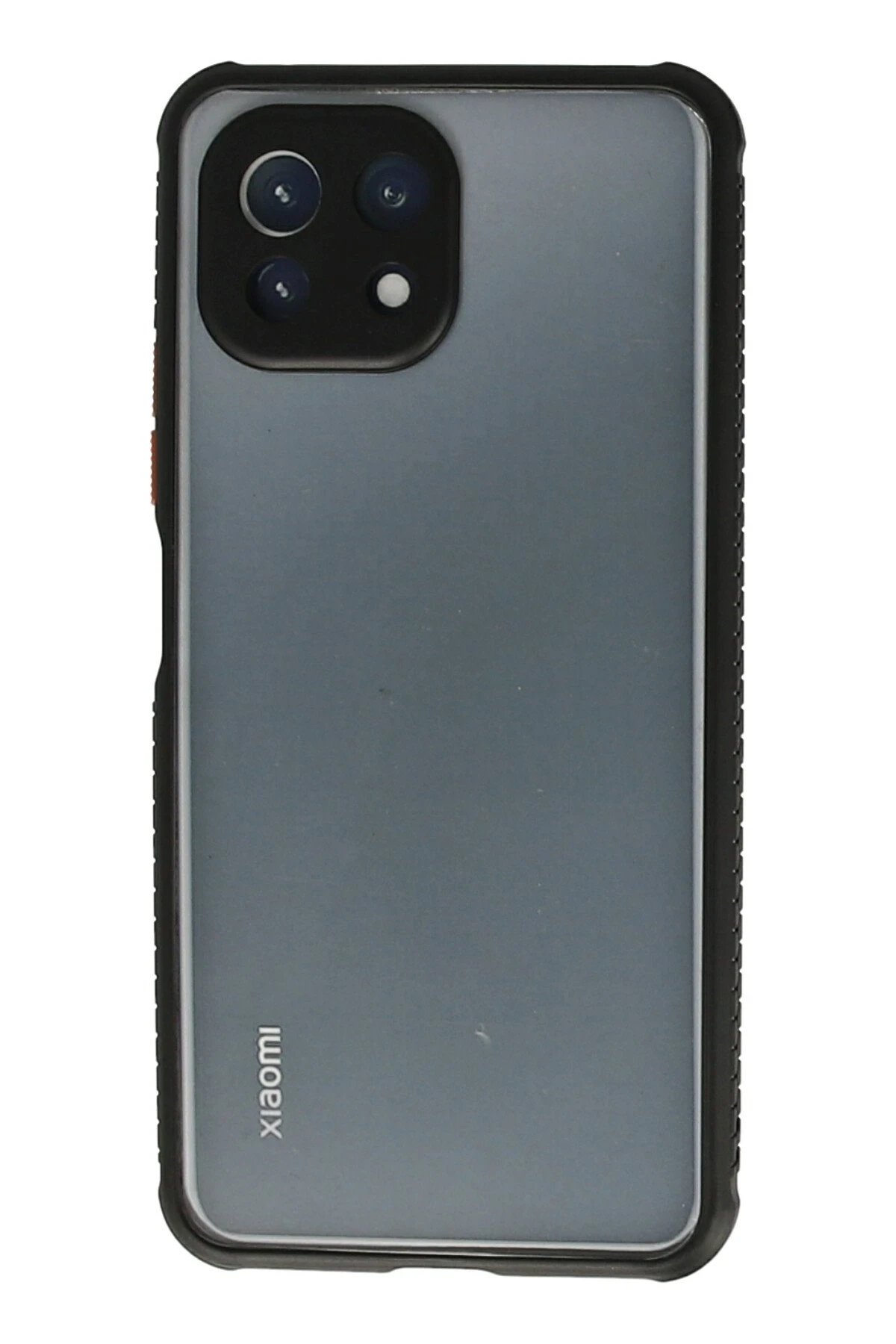 Newface Xiaomi Mİ 11 Lite Kılıf Miami Şeffaf Silikon - Siyah