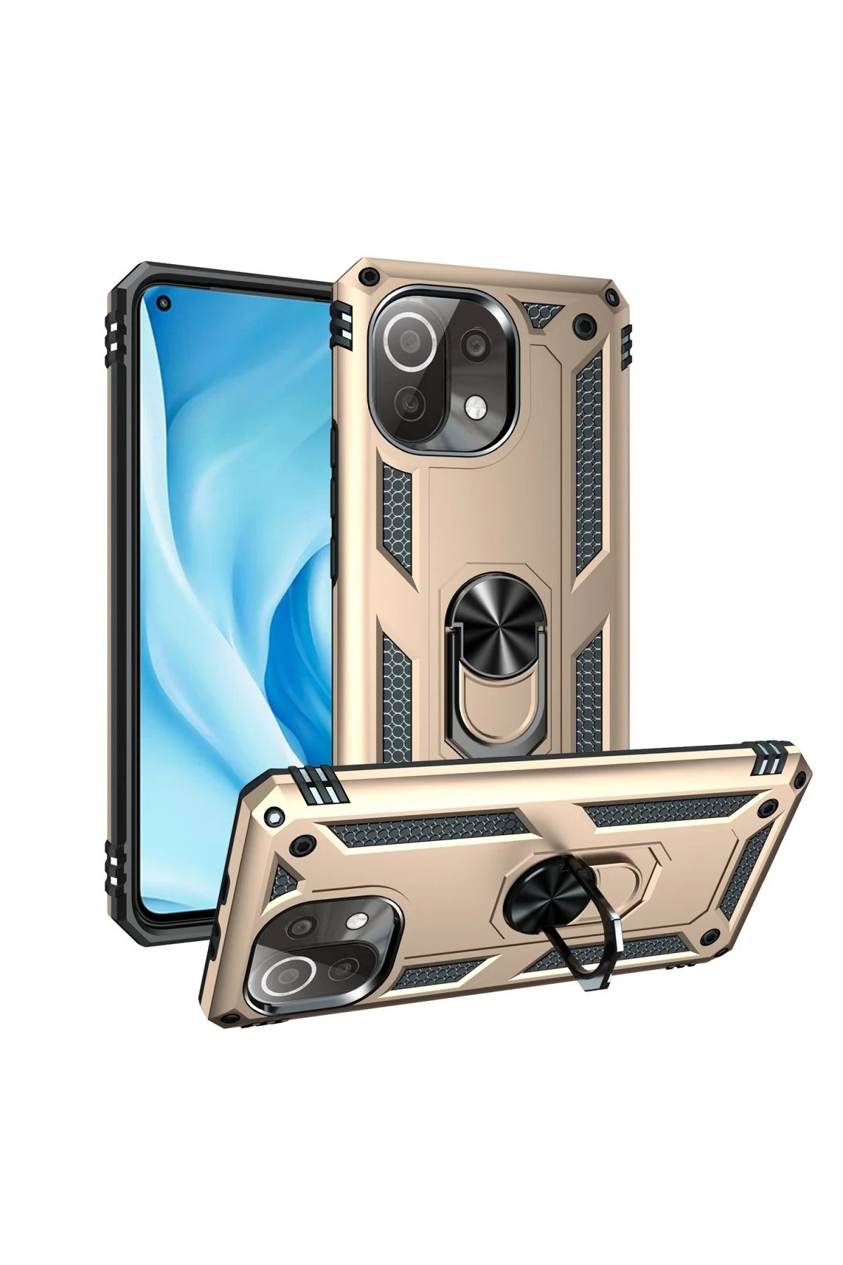 Newface Xiaomi Mİ 11 Lite Kılıf Sofya Yüzüklü Silikon Kapak - Gold