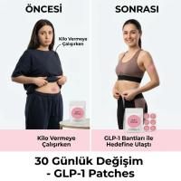 30 Adet Kilo Yönetimi Destek Bantları – İştah Kontrolü ve Günlük Wellness Desteği