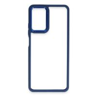 Newface Realme 10 Pro 5G Kılıf Dora Kapak - Mavi