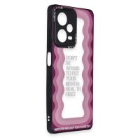 Newface Xiaomi Poco X5 Pro 5G Kılıf Mirror Desenli Kapak - Mirror - 11