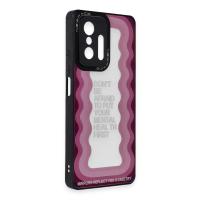 Newface Xiaomi Mi 11T Pro Kılıf Mirror Desenli Kapak - Mirror - 11