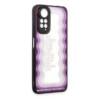 Newface Xiaomi Redmi Note 11 Kılıf Mirror Desenli Kapak - Mirror - 5