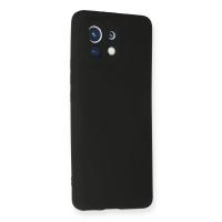 Newface Xiaomi Mi 11 Kılıf First Silikon - Siyah