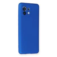 Newface Xiaomi Mi 11 Kılıf First Silikon - Mavi