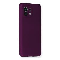 Newface Xiaomi Mi 11 Kılıf First Silikon - Mürdüm
