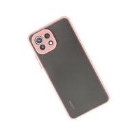 Newface Xiaomi Mİ 11 Lite Kılıf Montreal Silikon Kapak - Pembe