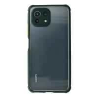 Newface Xiaomi Mİ 11 Lite Kılıf Miami Şeffaf Silikon - Koyu Yeşil