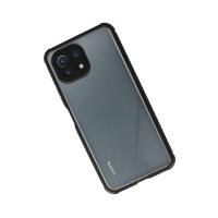 Newface Xiaomi Mİ 11 Lite Kılıf Miami Şeffaf Silikon - Siyah