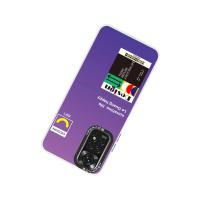 Newface Xiaomi Redmi Note 11 Kılıf Estoril Desenli Kapak - Estoril - 4