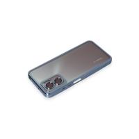 Newface Xiaomi Redmi 10 5G Kılıf Razer Lensli Silikon - Açık Mavi