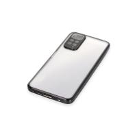 Newface Xiaomi Redmi Note 11 Kılıf Razer Lensli Silikon - Siyah